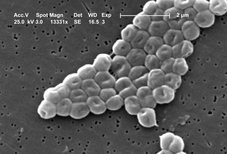 Zosurabalpin Un antibiotic nou și puternic care distruge bacteriile rezistente
