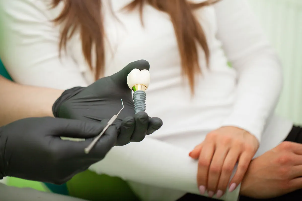 În cât timp îți poți pune un implant dentar? 2 implant-dentar